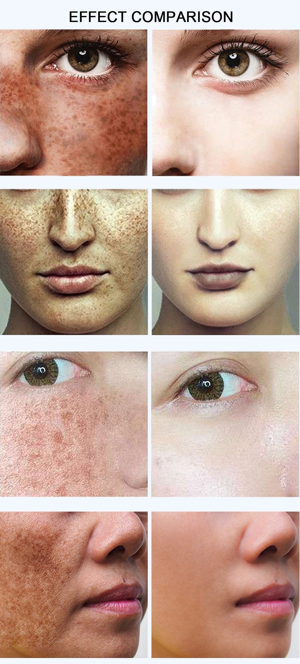 Advanced Dark Spot Corrector