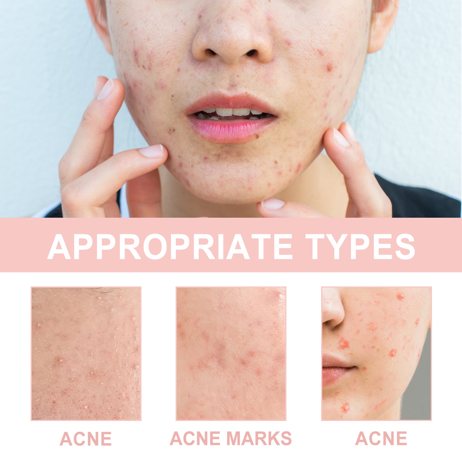 Redness Relief Hydrocolloid Patches