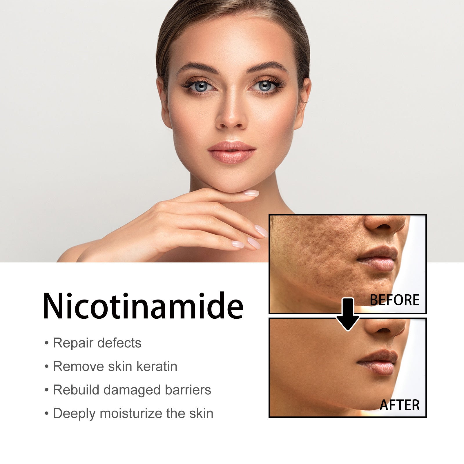 Niacinamide Tone-Correcting Serum