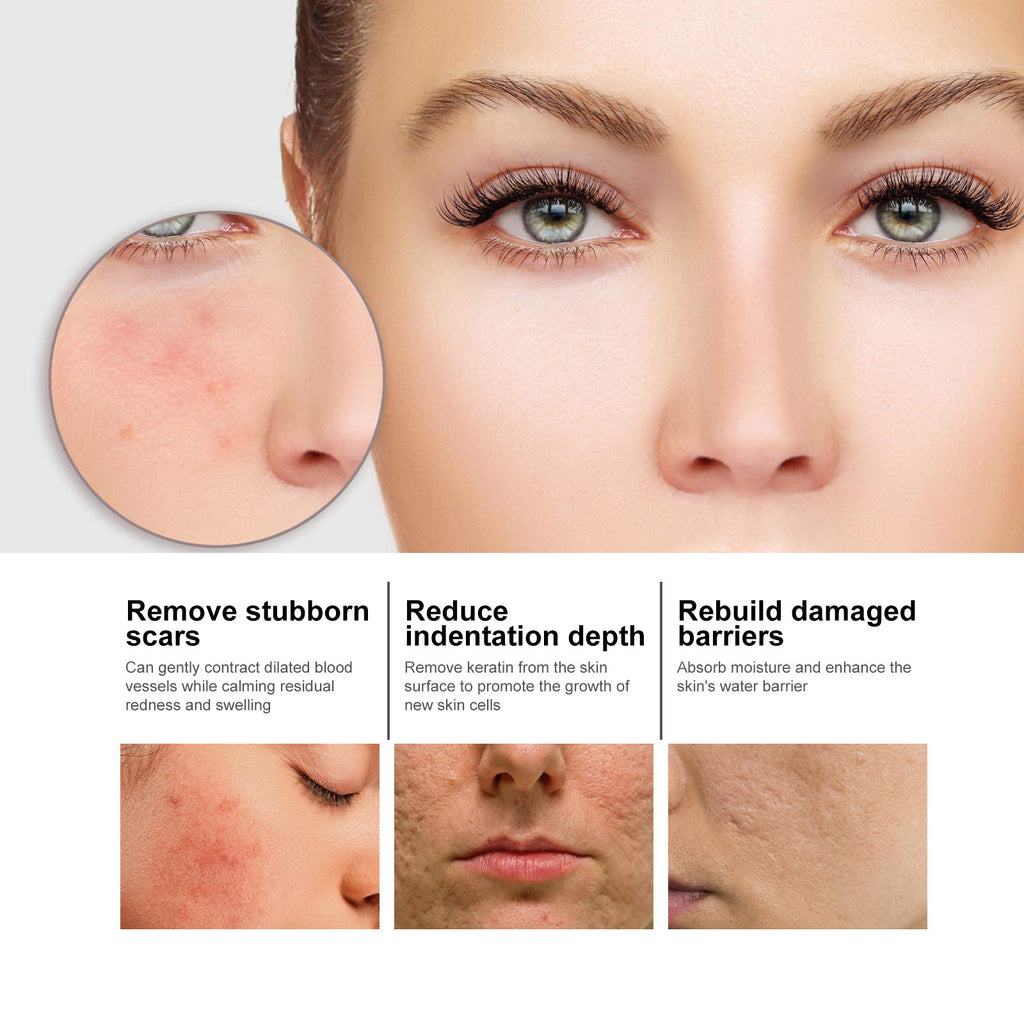 Niacinamide Tone-Correcting Serum