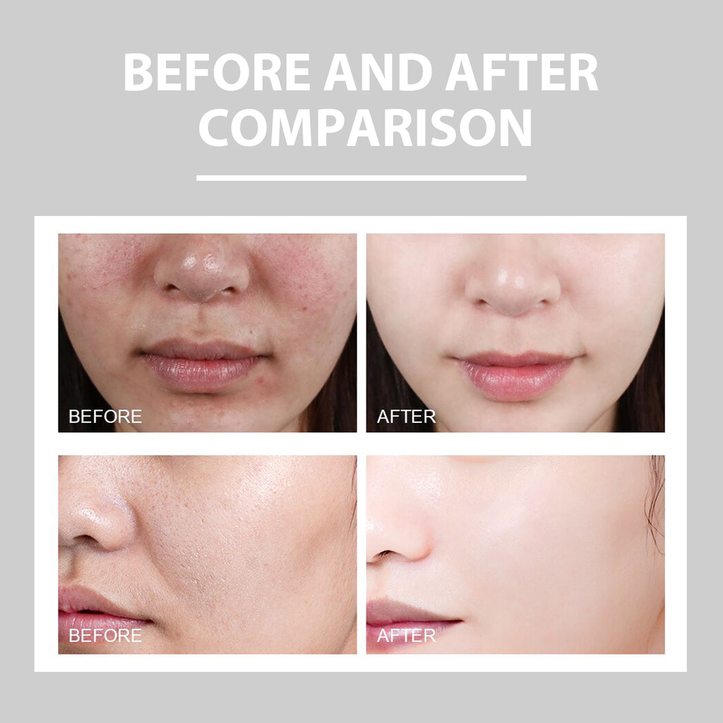 Soothing Redness Repair Cream