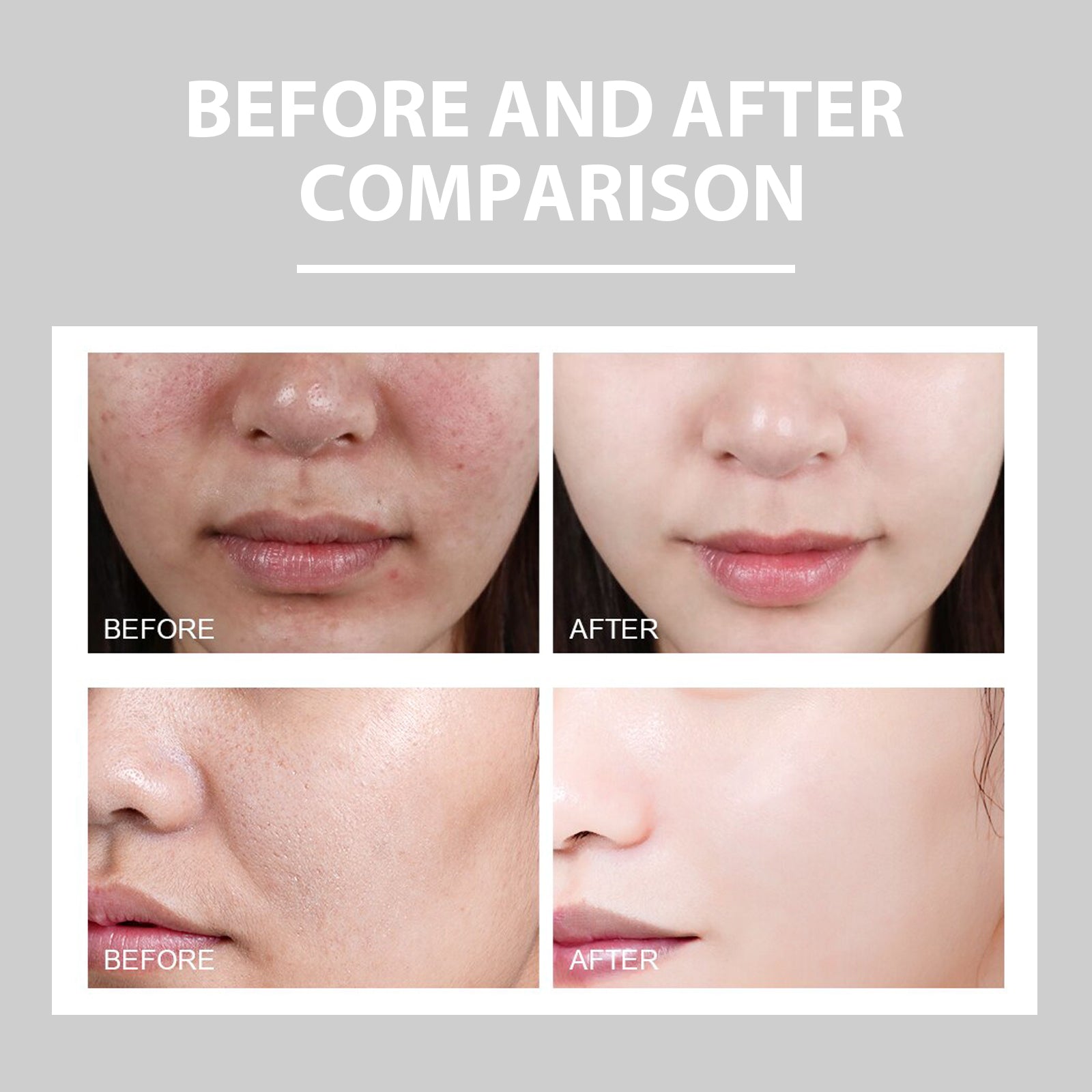 Soothing Redness Repair Cream