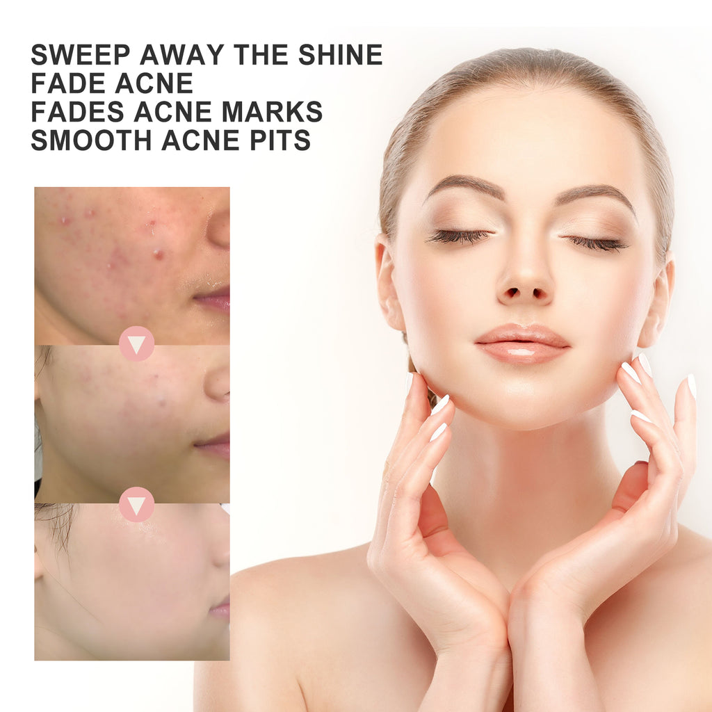 Redness Relief Hydrocolloid Patches